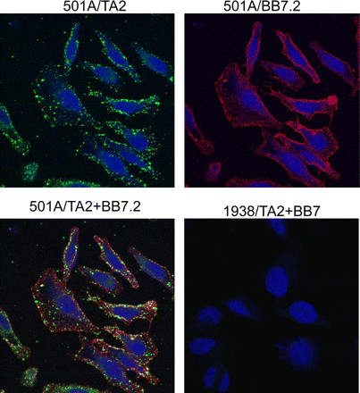 Immunofluorescence detection of HLA-A2-tyrosinase complexes on the surface of melanoma cells
